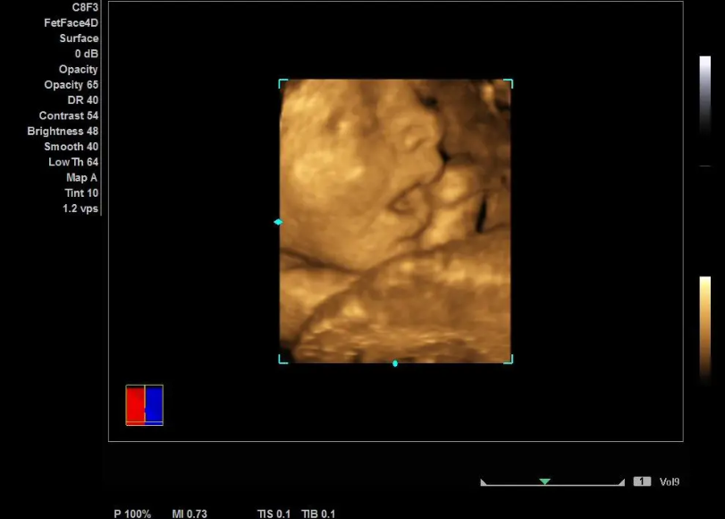 优效截图20250509151906.png